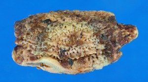 PSG 6 Acanthoxyla prasina ova
